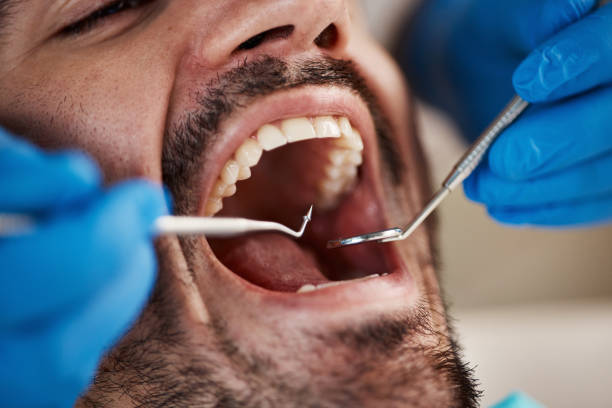 Best Emergency Tooth Extraction in La Joya, TX